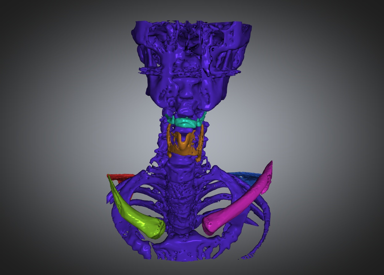CT2